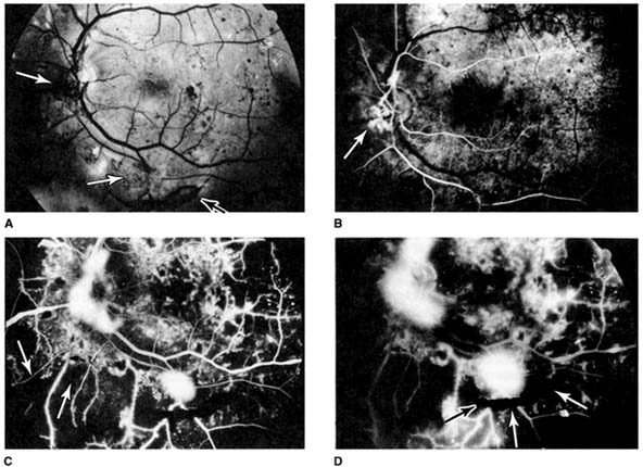 Figure 2-29